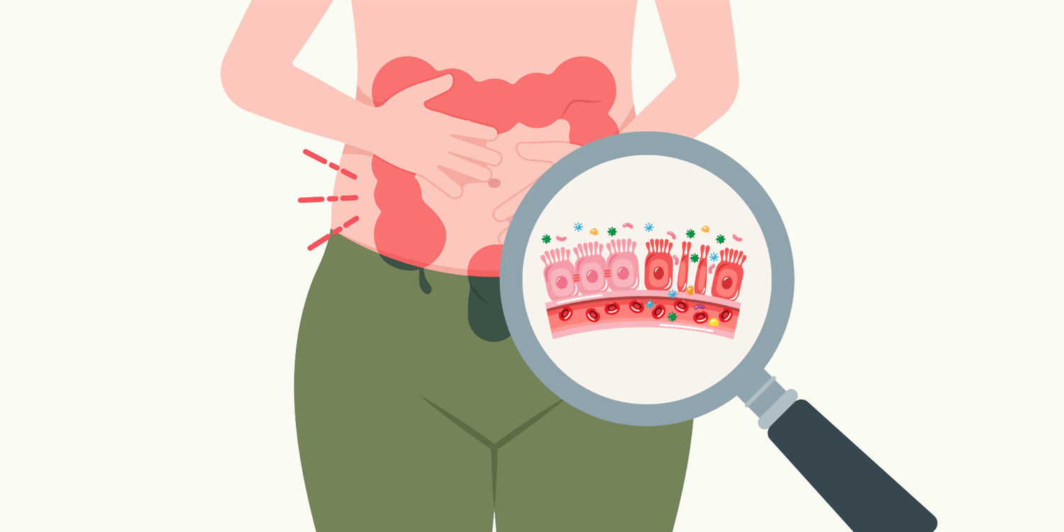 Leaky Gut: Wenn die Darmbarriere durchlässig wird - myBioma